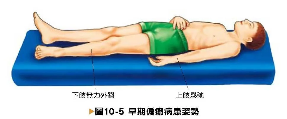 意識變化患者特殊姿態一