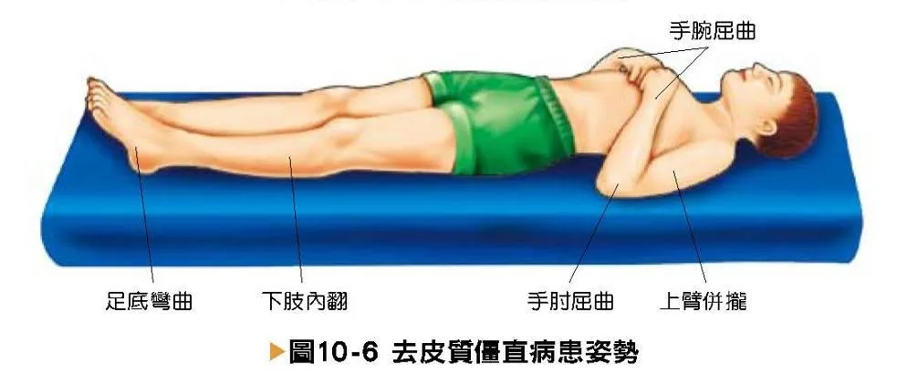 意識變化患者特殊姿態二