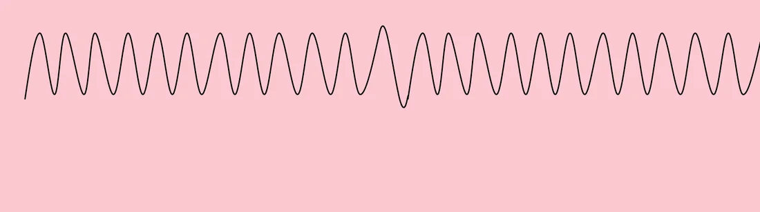 限制性肺病呼吸波形：淺而快