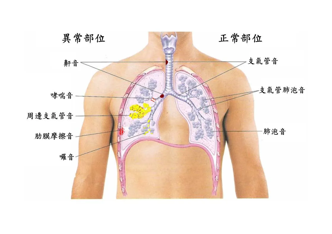 異常呼吸音成音示意圖