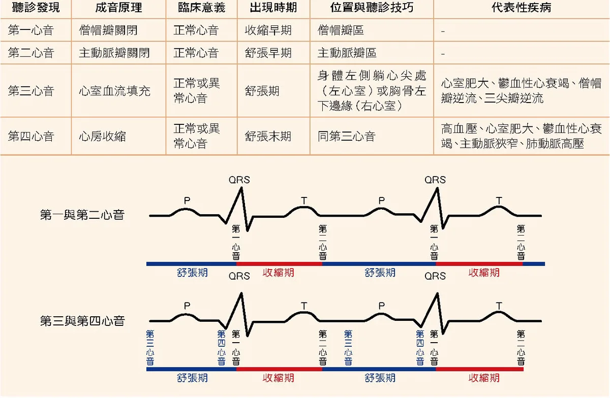 基本心音整理圖