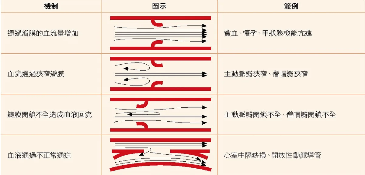 心雜音形成機轉示意