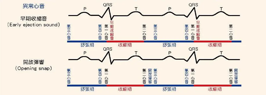 異常心音與心雜音整理表