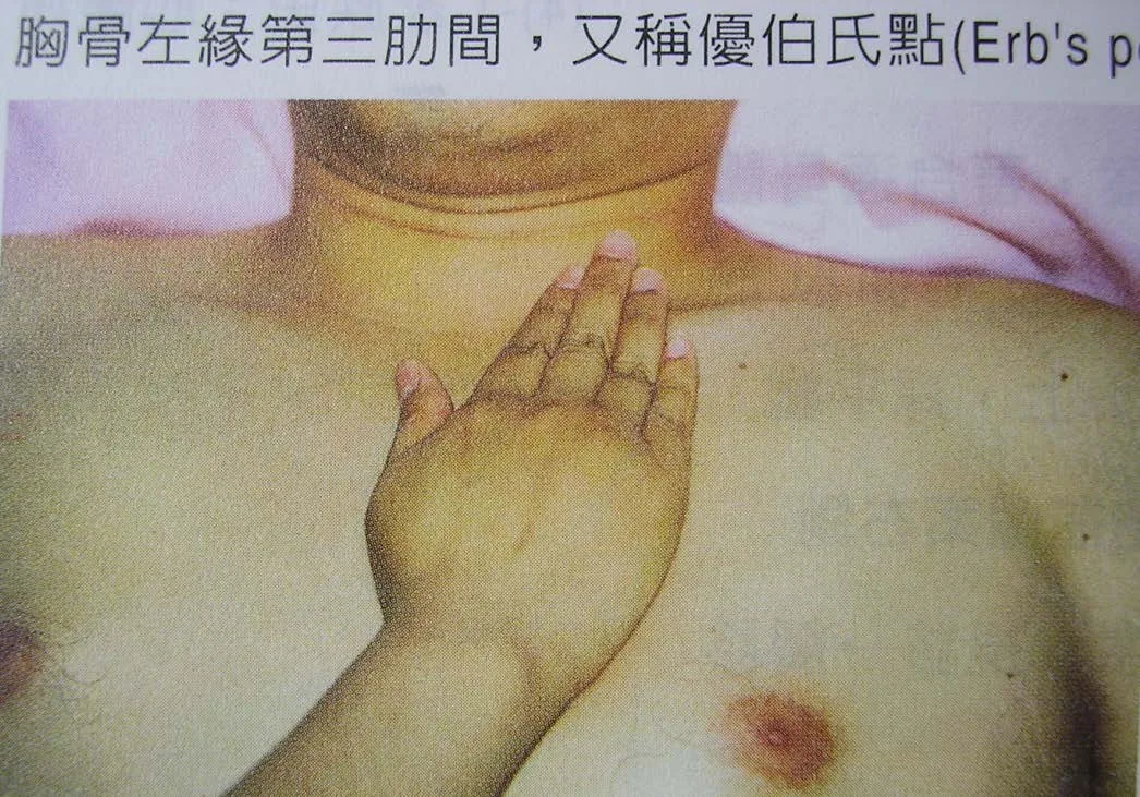 胸骨左緣三尖瓣區觸診