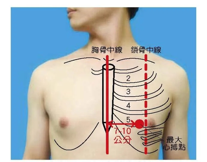 心尖搏動點的正常位置