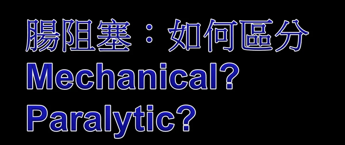 腸音聽診