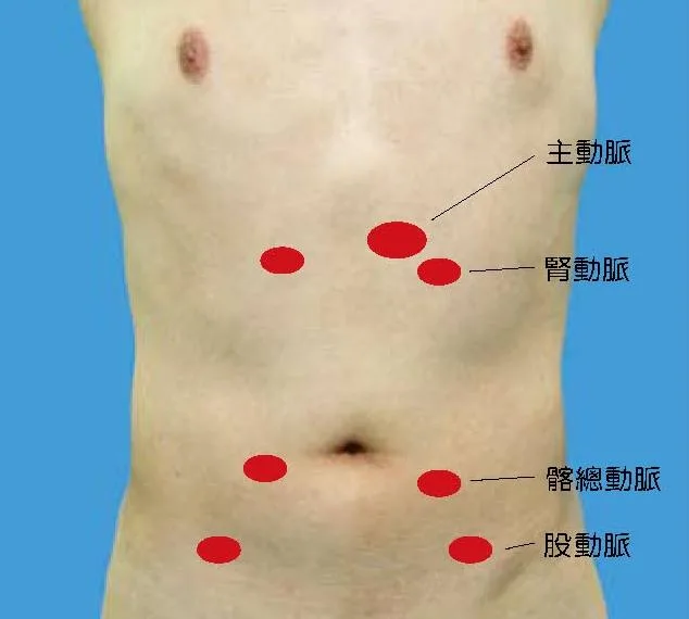 腹部血管嘈音的五個聽診位置
