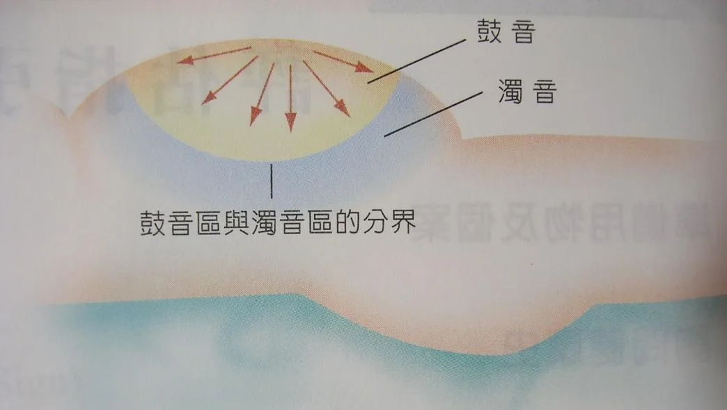 轉移性濁音的操作步驟