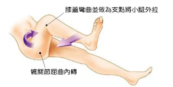 閉孔肌徵候操作