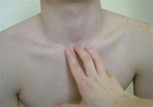 甲狀腺觸診
