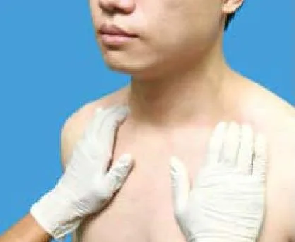 氣管位置評估