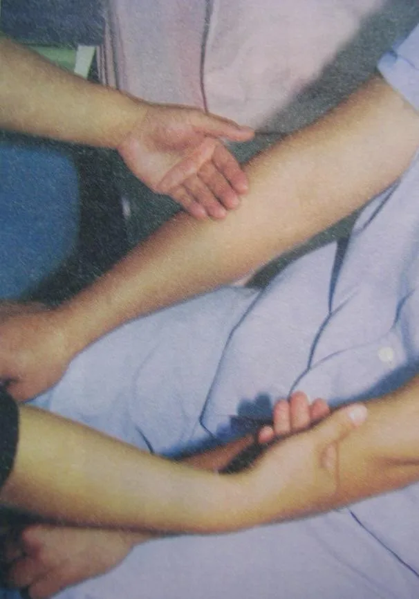 肢體水腫評估